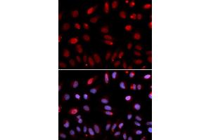 Immunofluorescence analysis of U2OS cells using HUS1 antibody (ABIN6131777, ABIN6142085, ABIN6142087 and ABIN6221056). (HUS1 Antikörper  (AA 1-280))