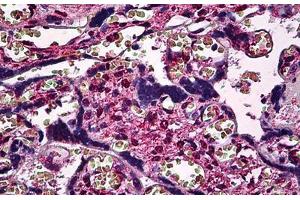 Human Placenta: Formalin-Fixed, Paraffin-Embedded (FFPE)