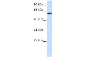 WB Suggested Anti-TRIM41 Antibody Titration:  0. (TRIM41 Antikörper  (Middle Region))