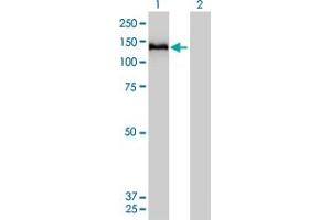 Western Blot analysis of COL6A2 expression in transfected 293T cell line by COL6A2 monoclonal antibody (M01), clone 2C5-F2. (COL6A2 Antikörper  (AA 1-425))