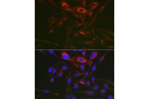 Immunofluorescence analysis of RD cells using PRK Rabbit pAb (ABIN6129909, ABIN6146189, ABIN6146191 and ABIN6218391) at dilution of 1:150 (40x lens). (PRKAG3 Antikörper  (AA 1-210))