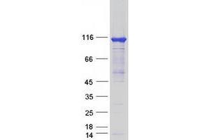 Western Blotting (WB) image for Hexokinase Domain Containing 1 (HKDC1) protein (Myc-DYKDDDDK Tag) (ABIN2722832)
