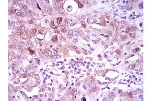 Image no. 2 for anti-ATP Citrate Lyase (ACLY) antibody (ABIN1491378) (ACLY Antikörper)