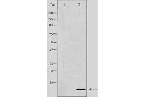 Western blot analysis of extracts from HeLa cells using COX17 antibody. (COX17 Antikörper  (N-Term))