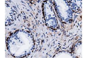 Immunohistochemical staining of paraffin-embedded Human liver tissue using anti-QPRT mouse monoclonal antibody. (QPRT Antikörper)