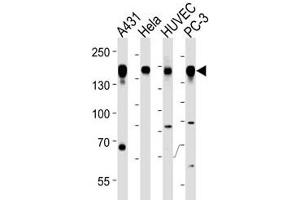 Epidermal Growth Factor Receptor antibody western blot analysis in A431, HeLa, HUVEC, PC3 lysate (EGFR Antikörper  (AA 1070-1099))