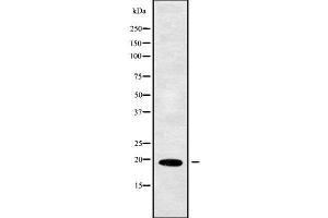 Western blot analysis of PPP3R1 using MCF7 whole cell lysates