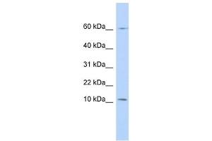 PI3 antibody used at 1 ug/ml to detect target protein. (PI3 Antikörper)
