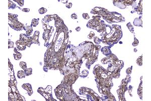 IHC analysis of Collagen IV using anti-Collagen IV antibody . (COL4A1 Antikörper  (AA 1445-1669))