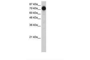 Image no. 2 for anti-Zinc Finger Protein 16 (ZNF16) (N-Term) antibody (ABIN6736214) (ZNF16 Antikörper  (N-Term))
