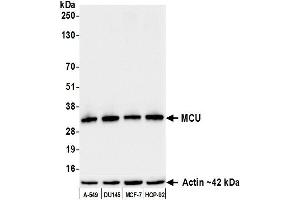Western Blotting (WB) image for anti-Mitochondrial Calcium Uniporter (MCU) (AA 300-350) antibody (ABIN7795789)