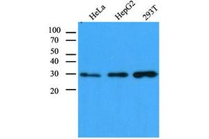 Western Blotting (WB) image for anti-Carbonyl Reductase 1 (CBR1) antibody (ABIN614308) (CBR1 Antikörper)