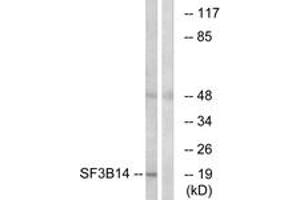 Western blot analysis of extracts from HepG2 cells, using SF3B14 Antibody. (Pre-mRNA Branch Site Protein p14 (SF3B14) (AA 76-125) Antikörper)