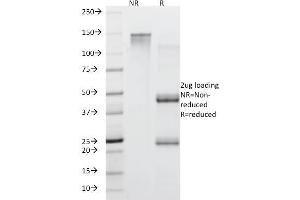 SDS-PAGE Analysis Purified MUC5AC Mouse Monoclonal Antibody (45M1). (MUC5AC Antikörper)