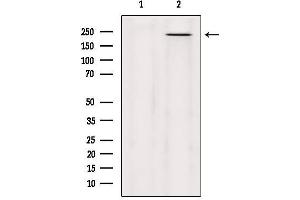 Western blot analysis of extracts from Hela, using MYO5C Antibody. (MYO5C Antikörper)