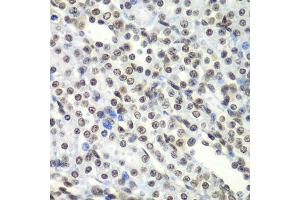 Immunohistochemistry of paraffin-embedded rat kidney using SF3B2 antibody. (SF3B2 Antikörper  (AA 616-895))