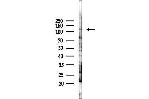 anti-KIAA0319 (KIAA0319) antibody