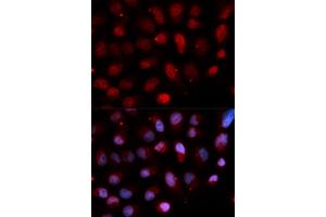 Immunofluorescence analysis of U20S cell using ETV4 antibody.