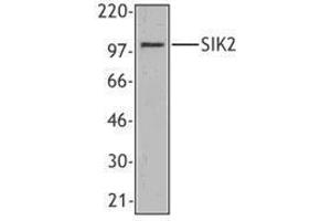 Western Blotting (WB) image for anti-Salt-Inducible Kinase 2 (SIK2) antibody (ABIN2666364) (SIK2 Antikörper)