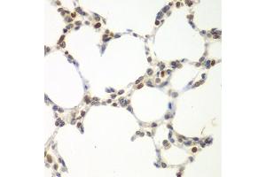 Immunohistochemistry of paraffin-embedded mouse lung using VRK1 antibody  at dilution of 1:100 (40x lens). (VRK1 Antikörper  (AA 257-396))
