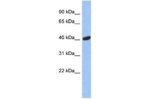 WB Suggested Anti-SIAH2 Antibody Titration: 0. (SIAH2 Antikörper  (Middle Region))