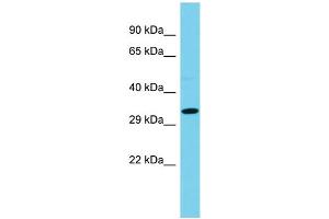 Host: Rabbit  Target Name: Ccdc42  Sample Tissue: Rat Pancreas lysates  Antibody Dilution: 1.