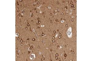 Immunohistochemical staining of human cerebral cortex with RRP15 polyclonal antibody  shows strong cytoplasmic positivity in neuronal cells at 1:200-1:500 dilution.