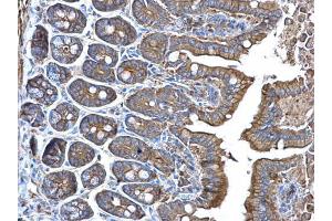 IHC-P Image alpha Adducin antibody detects alpha Adducin protein at membrane on mouse intestine by immunohistochemical analysis. (alpha Adducin Antikörper)