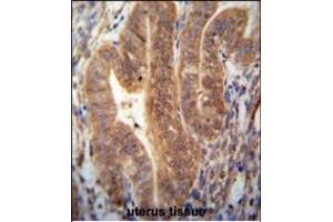 KI antibody (N-term) (ABIN654385 and ABIN2844131) immunohistochemistry analysis in formalin fixed and paraffin embedded human uterus tissue followed by peroxidase conjugation of the secondary antibody and DAB staining. (SHISAL1/KIAA1644 Antikörper  (N-Term))