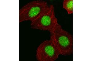 Fluorescent image of A549 cell stained with HMGA1 Antibody (C-term) (ABIN653050 and ABIN2842658).