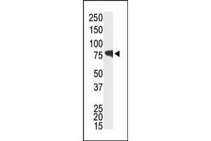 Image no. 1 for anti-Interleukin-1 Receptor-Associated Kinase 1 (IRAK1) (C-Term) antibody (ABIN360116) (IRAK1 Antikörper  (C-Term))