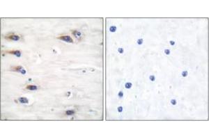Immunohistochemistry analysis of paraffin-embedded human brain, using KSR (Phospho-Ser392) Antibody. (KSR1 Antikörper  (pSer404))