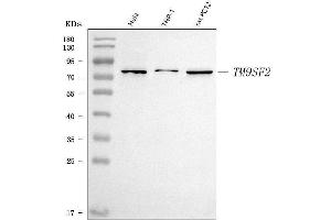 Western blot analysis of TM9SF2 using anti-TM9SF2 antibody (ABIN7602250).