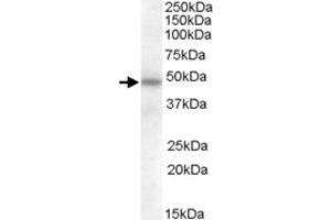 SERPINA12 polyclonal antibody  (0. (SERPINA12 Antikörper)