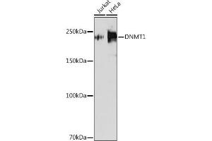 Western blot analysis of extracts of various cell lines, using DNMT1 antibody (ABIN7266808) at 1:1000 dilution. (DNMT1 Antikörper)