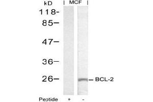 Image no. 2 for anti-B-Cell CLL/lymphoma 2 (BCL2) (Ser70) antibody (ABIN197204) (Bcl-2 Antikörper  (Ser70))