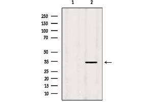 Western blot analysis of extracts from Hela, using MRPL19 Antibody. (MRPL19 Antikörper  (Internal Region))