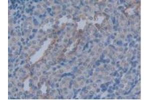 Detection of AQP4 in Rat Kidney Tissue using Polyclonal Antibody to Aquaporin 4 (AQP4) (Aquaporin 4 Antikörper  (AA 179-314))