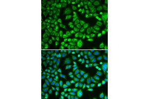 Immunofluorescence analysis of MCF-7 cells using PSMD7 antibody. (PSMD7 Antikörper  (AA 1-324))