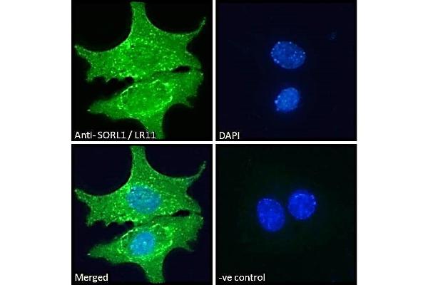 SORL1 Antikörper  (C-Term)