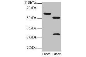 Western blot All lanes: ZNF384 antibody at 2 μg/mL Lane 1: EC109 whole cell lysate Lane 2: 293T whole cell lysate Secondary Goat polyclonal to rabbit IgG at 1/15000 dilution Predicted band size: 64, 57, 51 kDa Observed band size: 64, 51, 30 kDa (ZNF384 Antikörper  (AA 1-245))