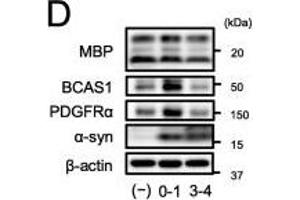 α-Syn PFF exposure to immature OLGs during differentiation-induced abnormal oligodendrogenesis. (BCAS1 Antikörper  (AA 542-584))