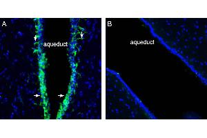 Expression of Cannabinoid Receptor 2 in rat midbrain aqueduct. (CNR2 Antikörper  (AA 228-242))