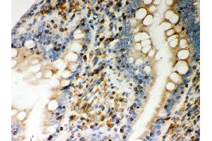 Anti- STIM1 Picoband antibody, IHC(P) IHC(P): Rat Intestine Tissue (STIM1 Antikörper  (N-Term))