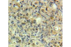 Used in DAB staining on fromalin fixed paraffin-embedded Ovary tissue (GRK5 Antikörper  (AA 304-532))