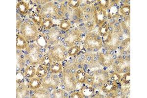 Immunohistochemistry of paraffin-embedded Mouse kidney using SMAD9 Polyclonal Antibody at dilution of 1:100 (40x lens). (SMAD9 Antikörper)