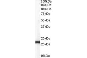 Western Blotting (WB) image for anti-Chromosome 15 Open Reading Frame 26 (C15orf26) (Middle Region) antibody (ABIN2785319) (C15orf26/CFAP161 Antikörper  (Middle Region))