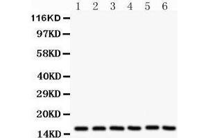 Western Blotting (WB) image for anti-Superoxide Dismutase 1, Soluble (SOD1) (AA 116-146), (C-Term) antibody (ABIN3043438) (SOD1 Antikörper  (C-Term))