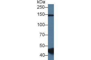 Detection of RBM20 in Porcine Skeletal muscle lysate using Polyclonal Antibody to RNA Binding Motif Protein 20 (RBM20) (RBM20 Antikörper  (AA 1089-1227))