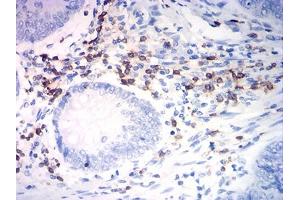 Immunohistochemistry (IHC) image for anti-CD7 (CD7) (AA 26-180) antibody (ABIN7193537)